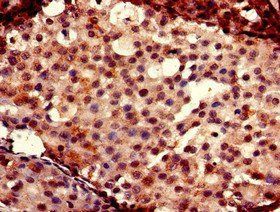 FOXC2 Antibody