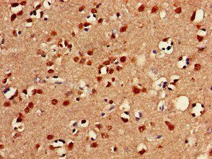 FOXC2 Antibody