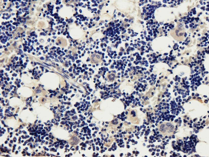 FOXO3A Rabbit Polyclonal Antibody