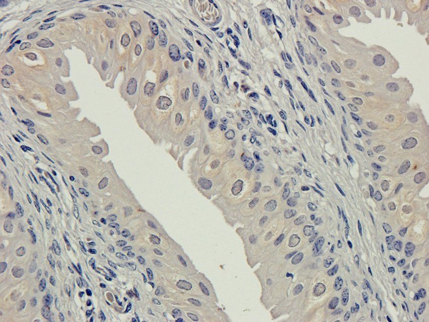 FOXO3A Rabbit Polyclonal Antibody