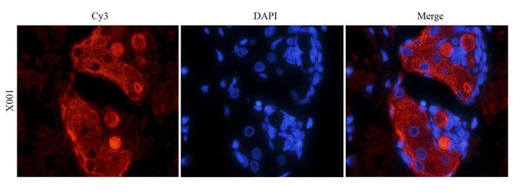 FOXP3 Rabbit Polyclonal Antibody