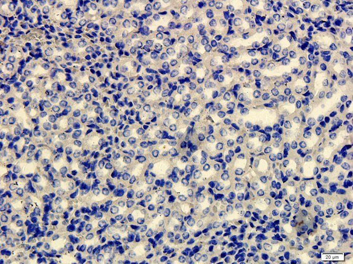 FOXP3 Rabbit Polyclonal Antibody