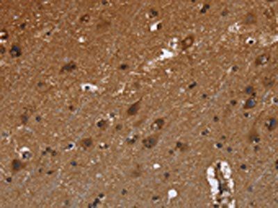 FRK Antibody