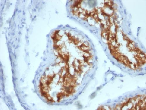 FSCN1 Antibody