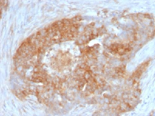 FSCN1 Antibody