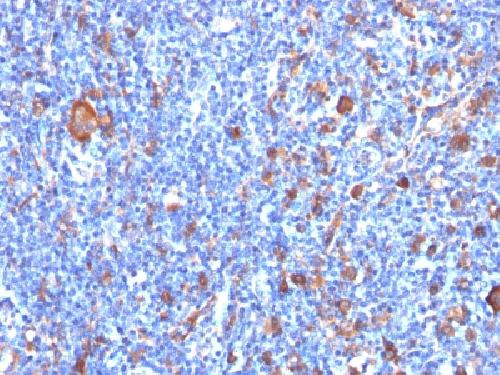 FSCN1 Antibody