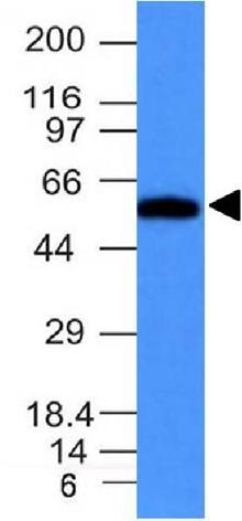 FSCN1 Antibody