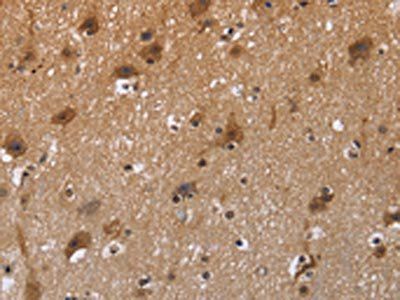 FSTL1 Antibody