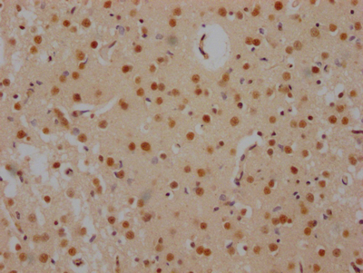FUBP1 Antibody