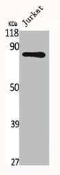 FYB1 Antibody