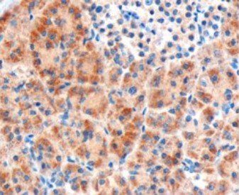 FZD8/frizzled 8 Antibody