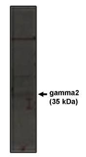 Rabbit anti Human Calcium Channel Antibody