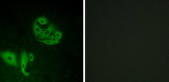 GPR20 Antibody