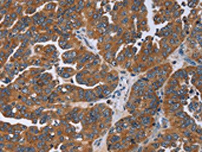 GAB2 Antibody