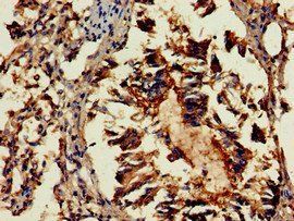 GAB2 Antibody