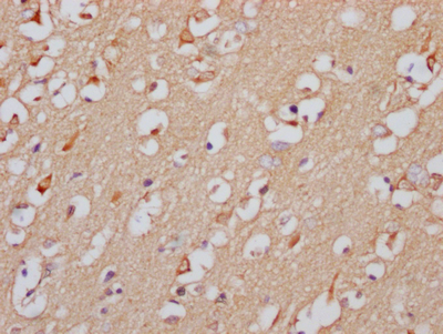 GABRA5 Antibody