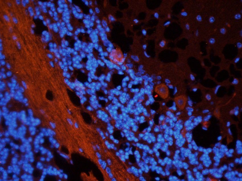 Gad1 Rabbit Polyclonal Antibody