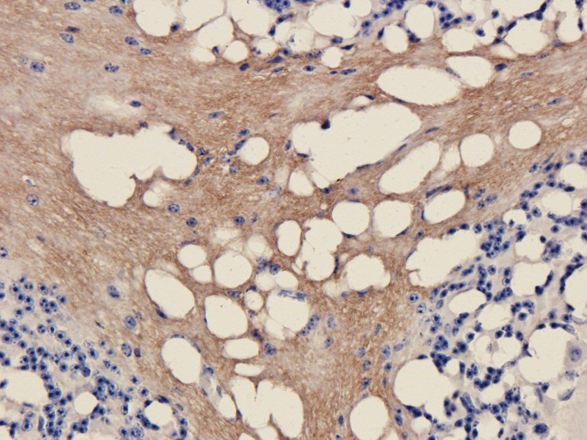 Gad1 Rabbit Polyclonal Antibody