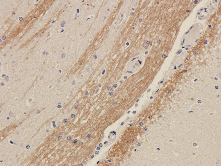 Gad1 Rabbit Polyclonal Antibody