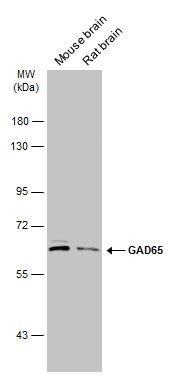 GAD65 Rabbit Polyclonal Antibody