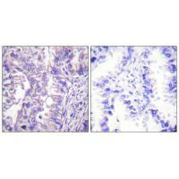 GAD2 Antibody