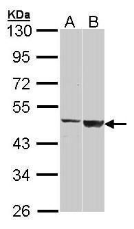 CSB Rabbit Polyclonal Antibody