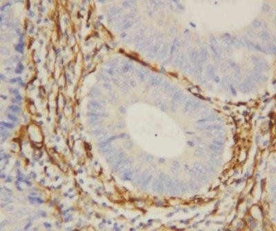 Galectin 1/LGALS1 Rabbit Polyclonal Antibody