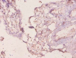 LGALS3 Antibody