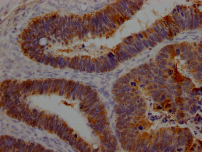 LGALS3 Antibody