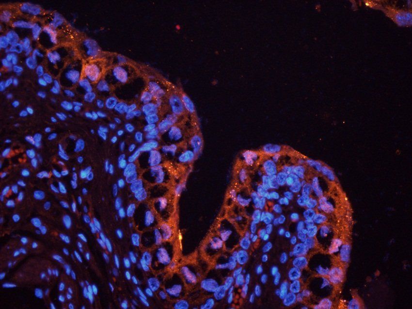 Galectin 3 Rabbit Polyclonal Antibody