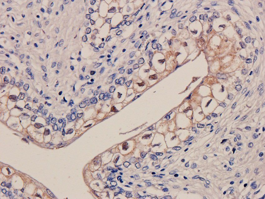 Galectin 3 Rabbit Polyclonal Antibody