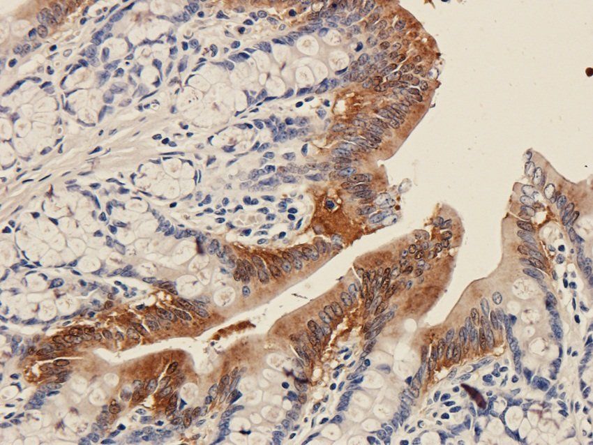 Galectin 3 Rabbit Polyclonal Antibody