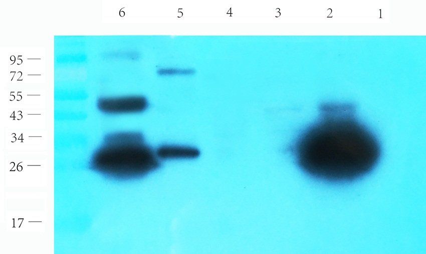 Galectin 3 Rabbit Polyclonal Antibody