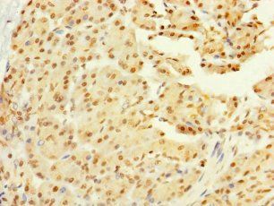 GALK2 Antibody