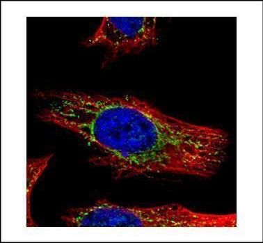 GALNS Rabbit Polyclonal Antibody