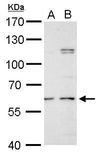 GALNS Rabbit Polyclonal Antibody