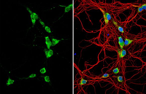 galanin receptor 2 Antibody