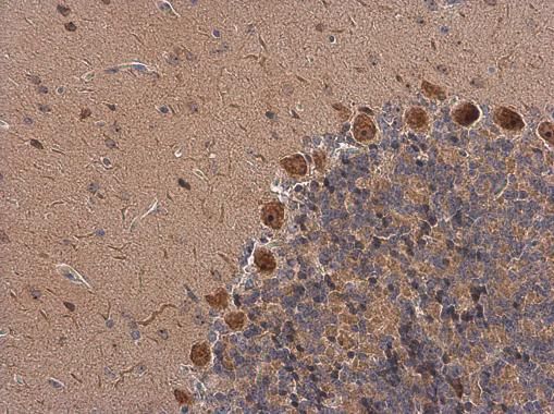 galanin receptor 2 Antibody