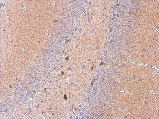 galanin receptor 2 Antibody