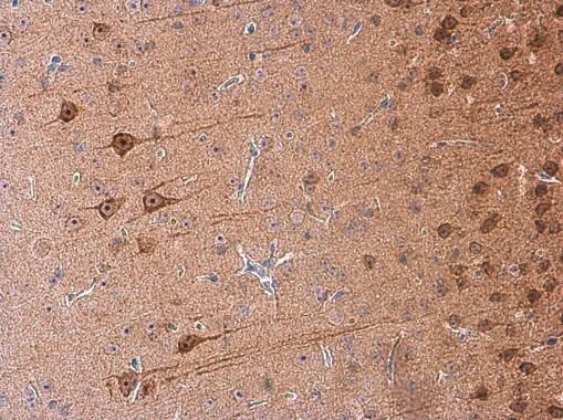 galanin receptor 2 Antibody