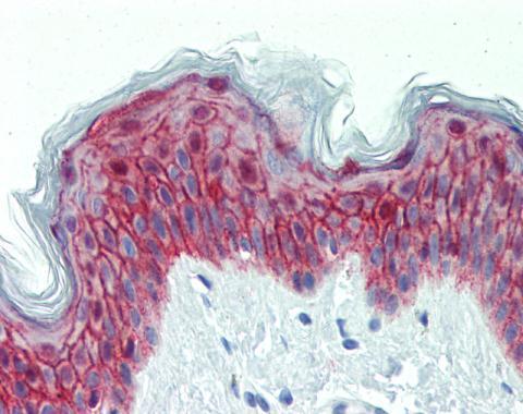 galanin receptor 2 Antibody