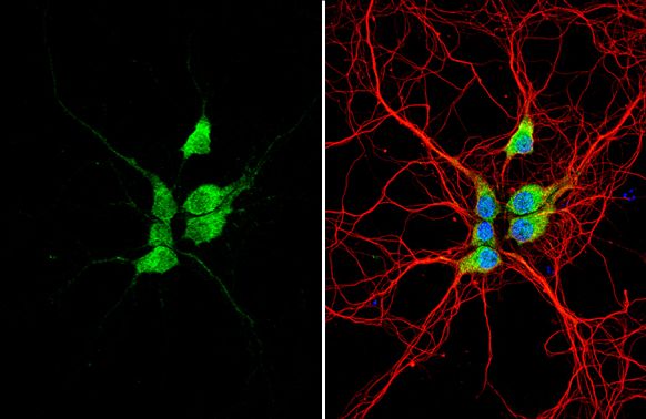 galanin receptor 2 Antibody
