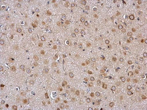 galanin receptor 2 Antibody