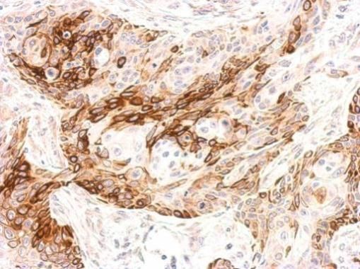 galanin receptor 2 Antibody