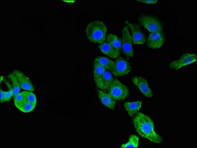 GARS Antibody