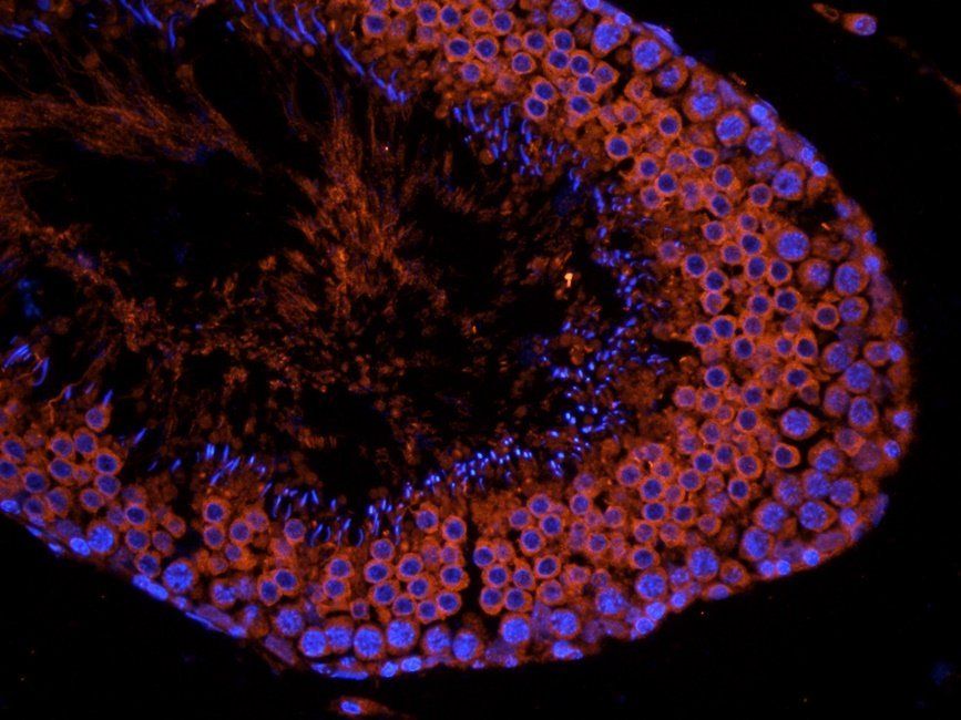 GAS6 Rabbit Polyclonal Antibody