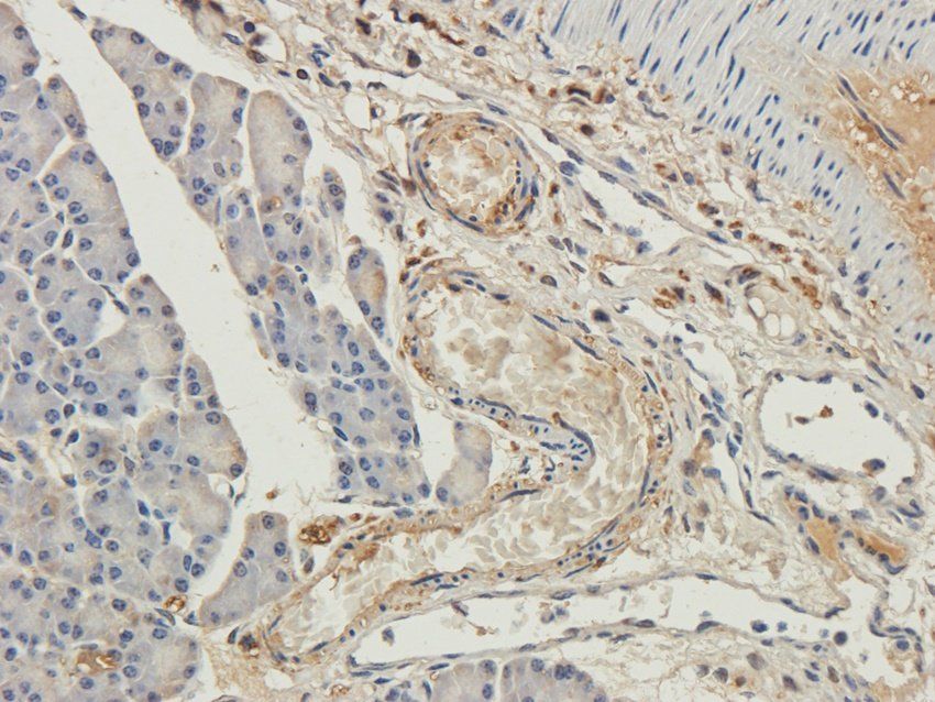 GAS6 Rabbit Polyclonal Antibody