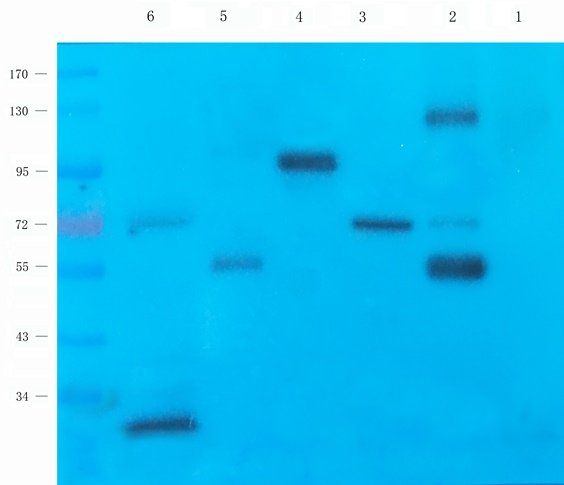 GAS6 Rabbit Polyclonal Antibody