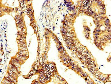 CCKBR Antibody