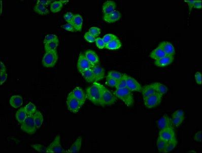 GRPR Antibody